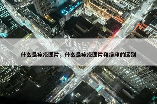 什么是痤疮图片，什么是痤疮图片和痘印的区别